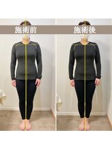 シェア 人形町店(Chare)/【小顔・骨盤矯正・О脚・整体】