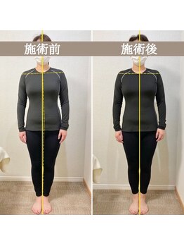 シェア 人形町店(Chare)/【小顔・骨盤矯正・О脚・整体】