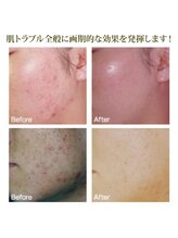 アネル 浦添店(anel)/