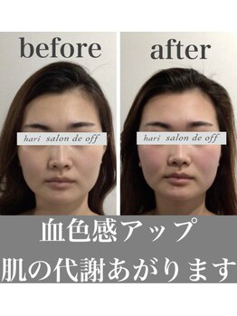 ハリサロンドオフ 心斎橋店(hari salon de off)/肌の代謝UP☆