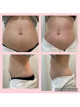 ルナート(Lunart)/【腸もみ】でぽっこり解消