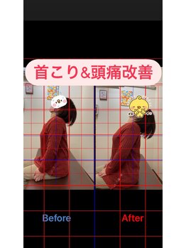 ヒデ整体院(Hide整体院)/姿勢矯正&骨盤矯正で根本改善