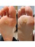 【フットケア人気NO.１】爪カット+甘皮処理+踵ケア+パラフィンパック6500