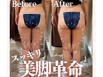 ラフィール