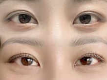 シャローム アローヴ(shalom alob)/マツパビフォーアフター