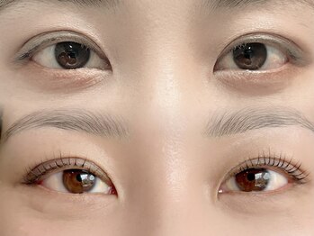 シャローム アローヴ(shalom alob)/マツパビフォーアフター