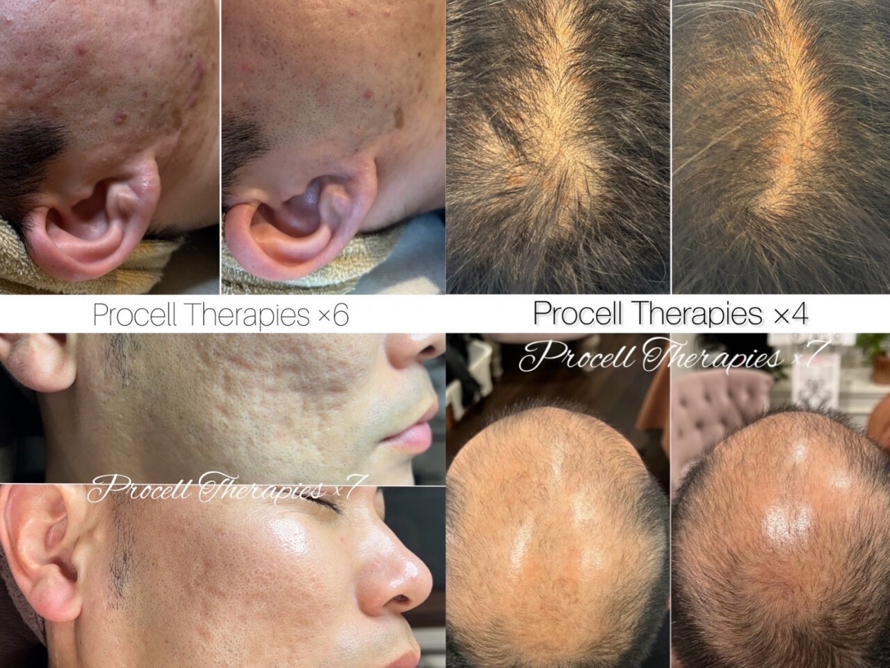 セリジェ 青山｜ホットペッパービューティー