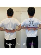 フロン(FroN)/肩甲骨はがし