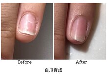 アンベリール(embellir.)/自爪育成/深爪育成/噛み爪育成