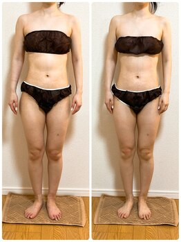 ソレイユ 北千住店(soleil)/全身が整う変化の記録（1）