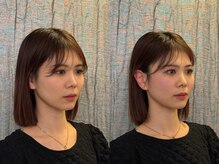 コガオ レンネ(Lenne)の雰囲気（ビフォーアフター[小顔矯正/美容鍼]駐車場有り）
