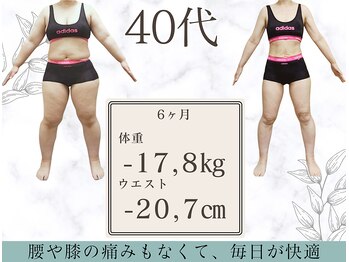 さくら通り美容整体院の写真/気になる二の腕・ハミ肉ケアで、好きな服を着こなせる理想の体型に♪美しい後ろ姿を手に入れ姿勢美人へ◇