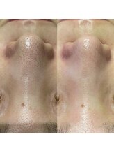 アネル 豊見城(anel)/