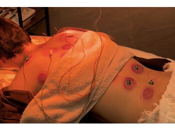 デルタエヌピー63+(δnp63+)/カッピング[福岡/薬院/美容鍼]