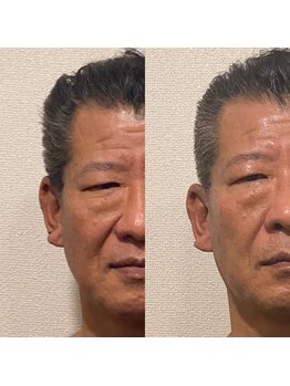 ラクーン 武蔵小杉(raccoon)/いけオジ作成中♪