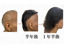 メンズブリリアンス(MEN’s BRILLIANCE)の雰囲気（【ヘッドグロウ/ヘッドブースト】ハーブでヘアサイクルを正常に）