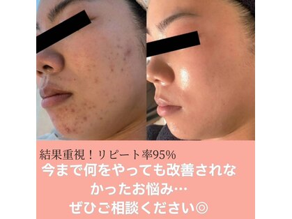 プログレス(PROGRESS)の写真