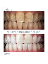 ホワイトニングショップ 姫路店/ホワイトニング