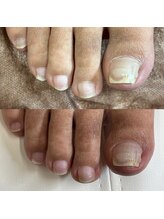 リリ(lili)/フットケア/ネイルケア