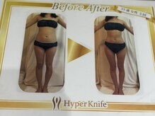 ビューティーボディー 小岩(Beauty Body)/