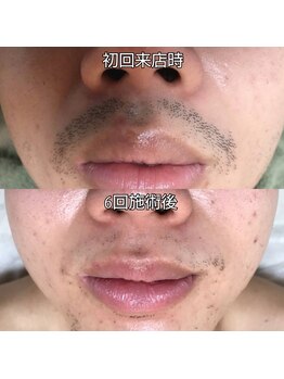 ナゴミ 金沢店(nagomi)/一緒に高効果を目指しましょう！