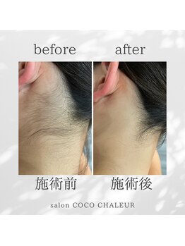 ココ シャルール(salon COCO CHALEUR)/Before　After