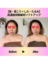 ミサ/フェィシャルエステ