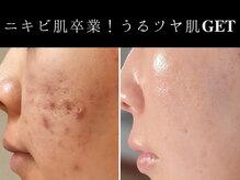 ユウビジン(YOU美人)/