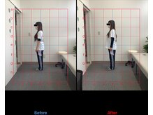 リード整骨院(LEAD整骨院)/姿勢改善、猫背、反り腰