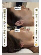 マウム(Maum)/輪郭ケア