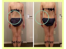 ヨサパーク コクリ(YOSA PARK kokuRi)/深部リンパマッサージが肝心！