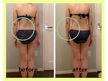 ヨサパーク コクリ(YOSA PARK kokuRi)/深部リンパマッサージが肝心!