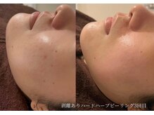 アイル 江坂店(iru)/