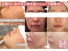 肌悩み・エイジング・コスメ相談まで！完全オーダーメイド美肌プラン 60分～