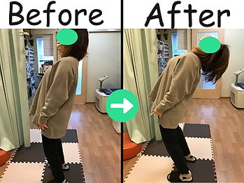 杉本接骨鍼灸院/痛み止めでも揉んでもダメだった