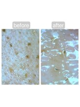 トランク(Trunk)/エアバリ♪ゴールドコース