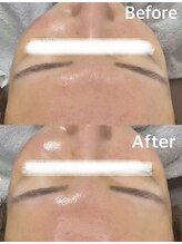 salon結(yui)/ララピール　ビフォーアフター