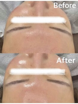 salon結(yui)/ララピール ビフォーアフター