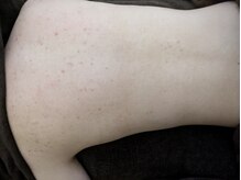 リデザイン 京都(REDESIGN)/REDESIGN京都中医施術法