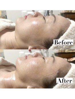 ステラ(Stella)/新メニュー【光フォト】