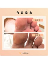 ココネ(cocone)/SPフットケア