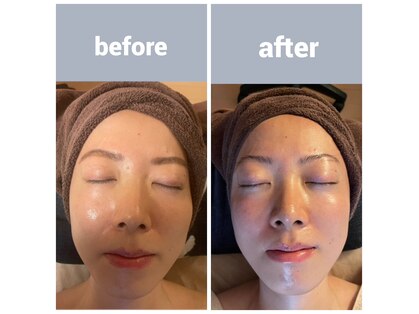 ディグニータココ 自由が丘(DIGNITA coco)の写真