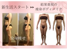 ムーン 高崎店(MOON)/セルゼロ痩身