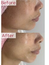 プレイス 堂山本店(PLACE)/レッドショット