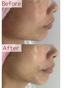 プレイス 堂山本店(PLACE)/レッドショット