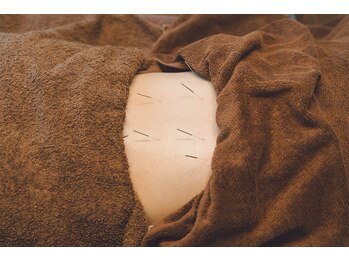 ウギィ(ugi-)の写真/慢性的な肩こり腰痛に◎自律神経を整える鍼灸で深いコリへアプローチ！施術前に丁寧にご説明します☆