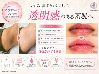 ノノサロン(nono salon)の写真