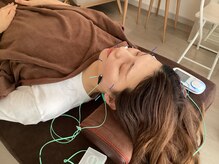 ハリファ鍼灸院 横浜関内院(HariFa鍼灸院)/美容鍼施術/美容鍼