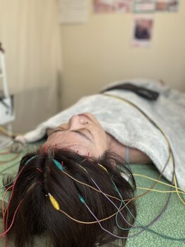 久心宝鍼灸院/~とにかく頭鍼~