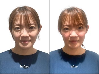 福多整体院/ブライダル前の集中ケア